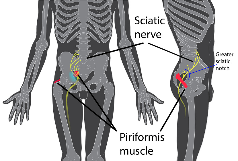 3. The Piriformis. Is your wallet pressing on it when you’re sitting. PATRICK J LYNCH via WIKIMEDIA COMMONS